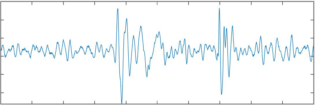 PCG waveform visualized